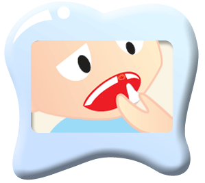 Broken Tooth Dental Emergency | Dentist Mayfield