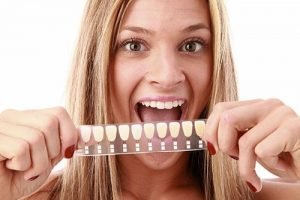 Dental Veneers | Dentist Mayfield