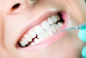 Gum Disease Treatment | Dentist Mayfield