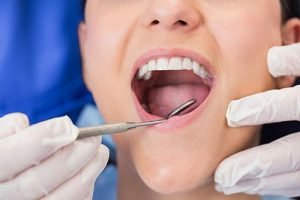 Preventive Dentistry | Dentist Mayfield