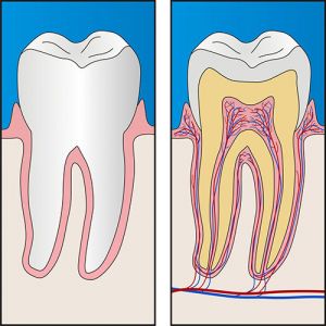 Root Canal Treatment | Dentist Mayfield