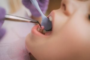 Mayfield Dental Care | Dentist Warabrook