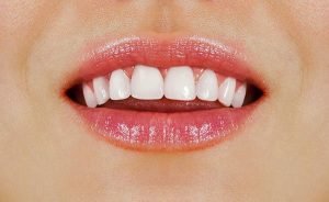Healthier and Whiter Teeth 6 Tips From Your Mayfield Dentist f