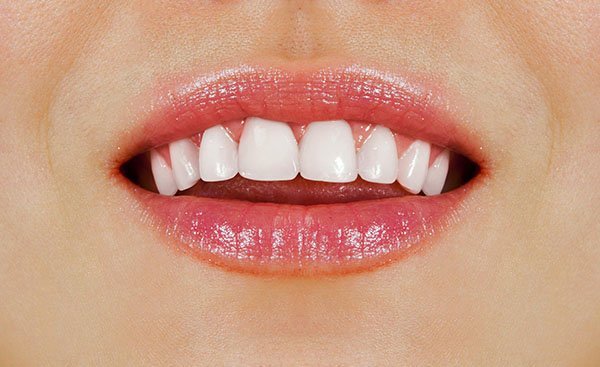 Healthier and Whiter Teeth: 6 Tips From Your Mayfield Dentist