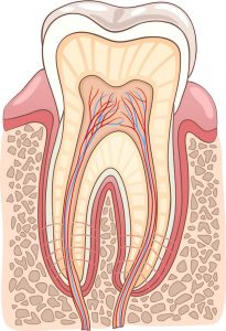 Signs a Root Canal may be Necessary Dentist Mayfield