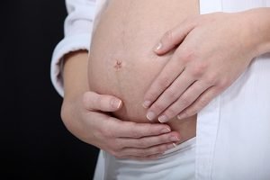 Dental Problems and Your Pregnancy | Dentist Mayfield