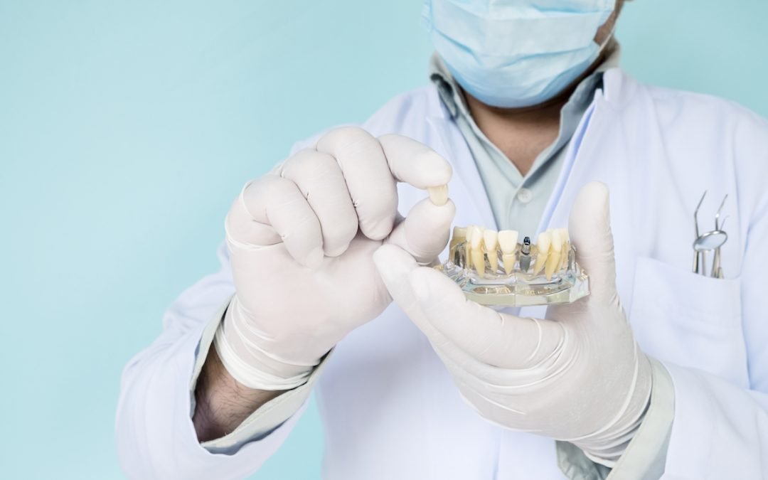 Mayfield Dentist tips on replacing missing teeth