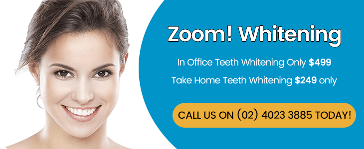 Zoom Whitening Banner Dentist Mayfield